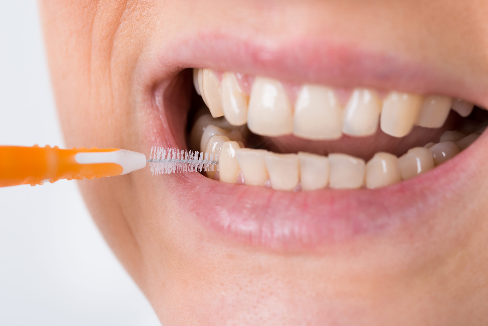 The importance of interdental cleaning and how to do it